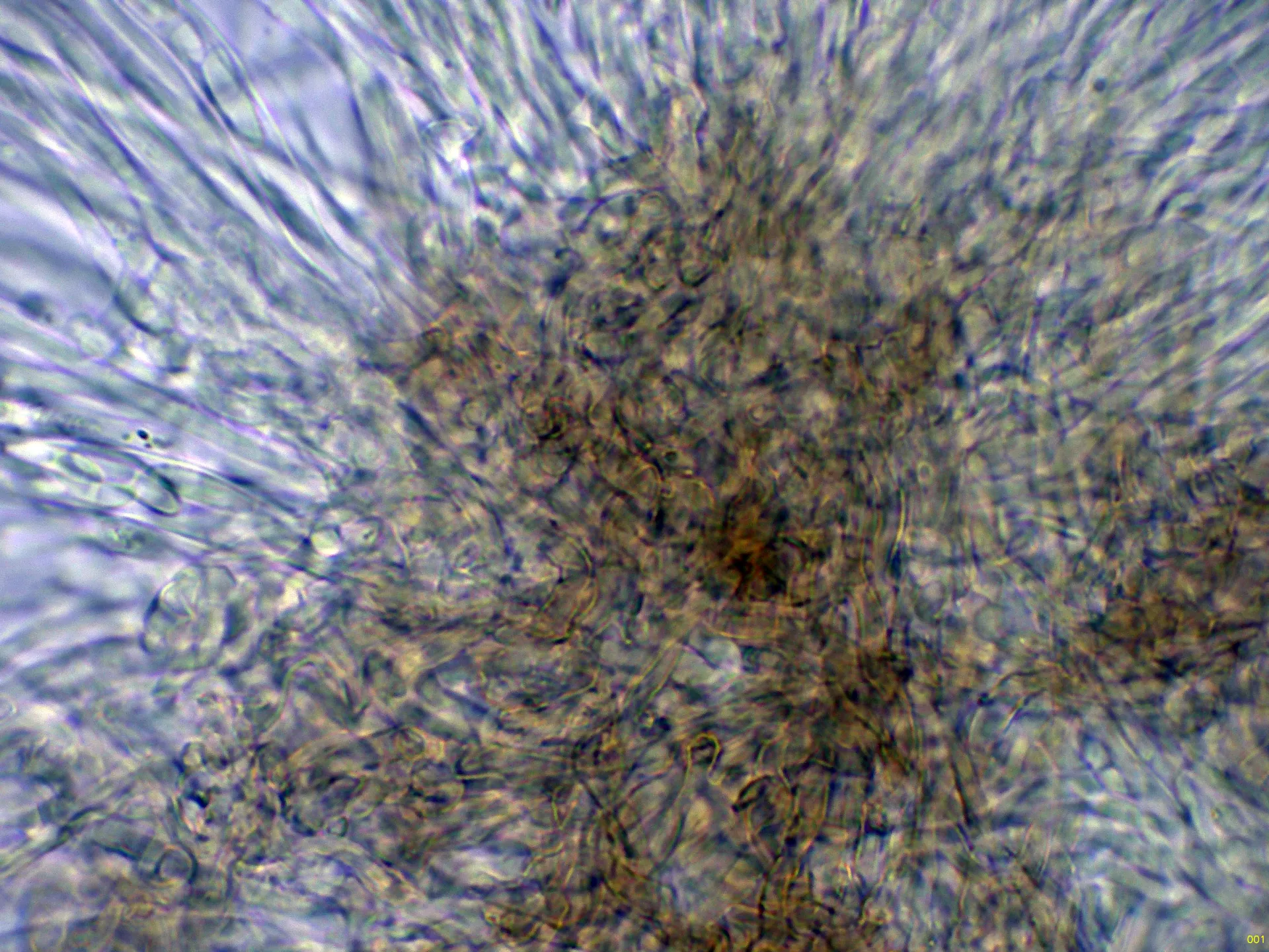 10 - Excípulo medular Melzer-001